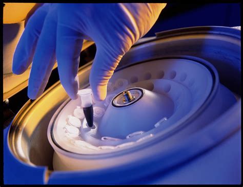 blood centrifuge|centrifuge blood definition.